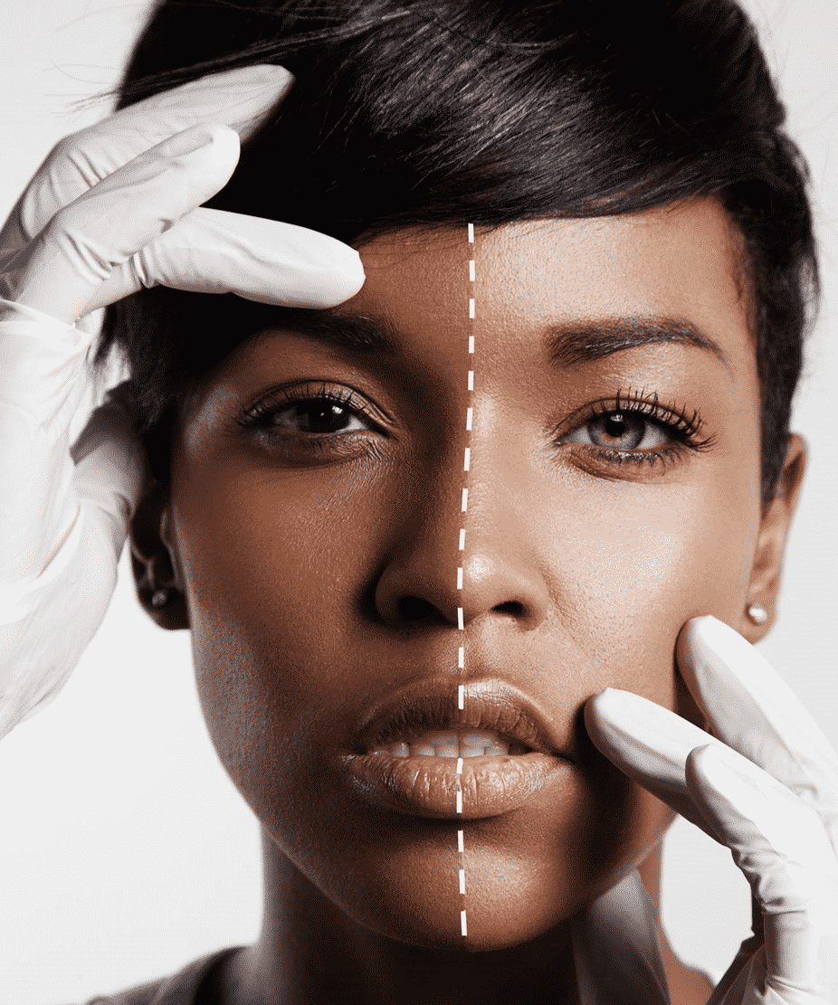 Skin Lightening Dangerous Ingredients